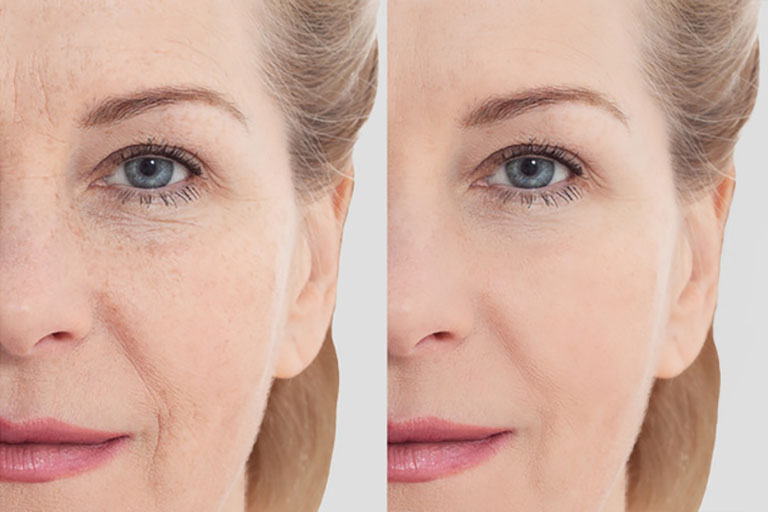 5 من أقوى منتجات سيروم الوجه لمقاومة التجاعيد واخفاء علامات الشيخوخة (Anti-aging) لجيل فوق ال40
